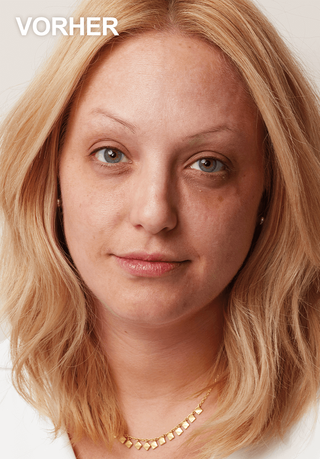 Frau ohne CC Cream mit unebenem Hautbild