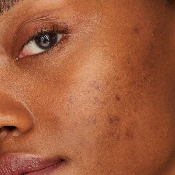 Haut mit Problemen IT Cosmetics 