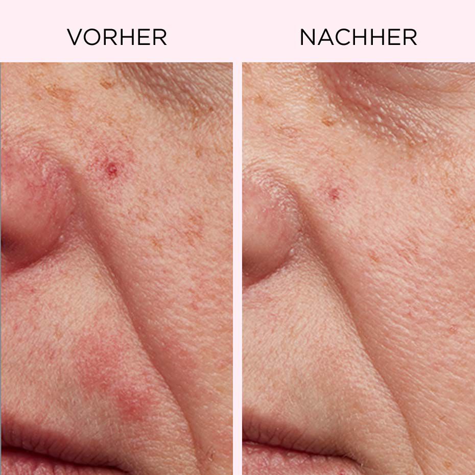 Vorher Nachher Bilder der 10 Tage Master Reinigung