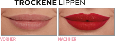 trockene lippen