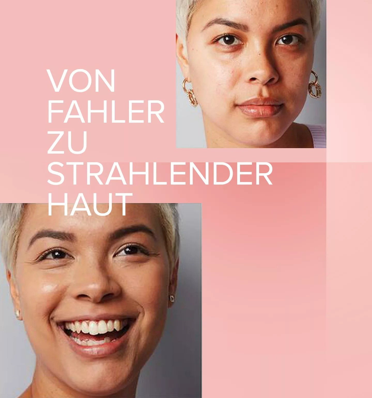 Entstehung von Pigmentflecken