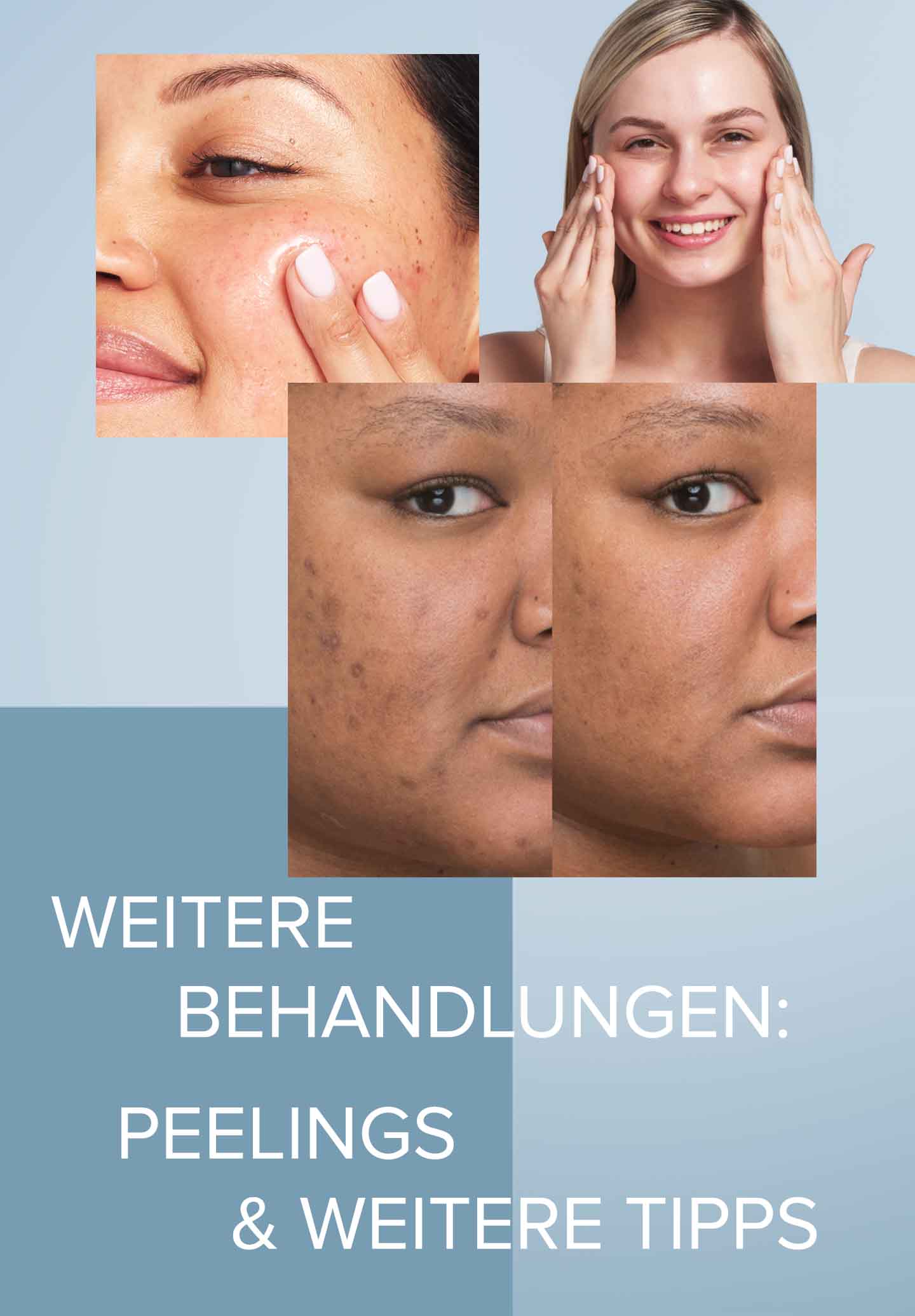 Tipps bei Pigmentflecken