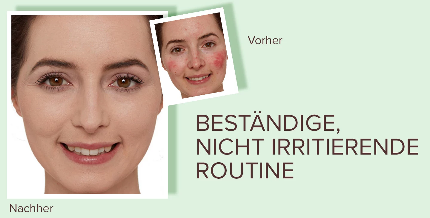 Entstehung von Pigmentflecken