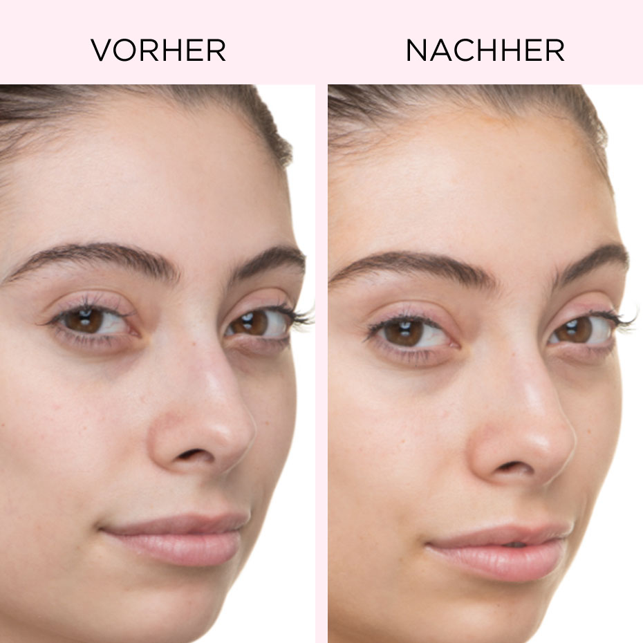Bye Bye Dullness 15% Vitamin C Serum Vorher/Nachher
