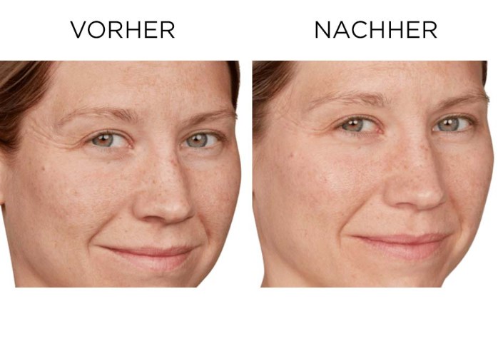 Confidence in your Beauty Sleep Vorher/Nachher Beispiel