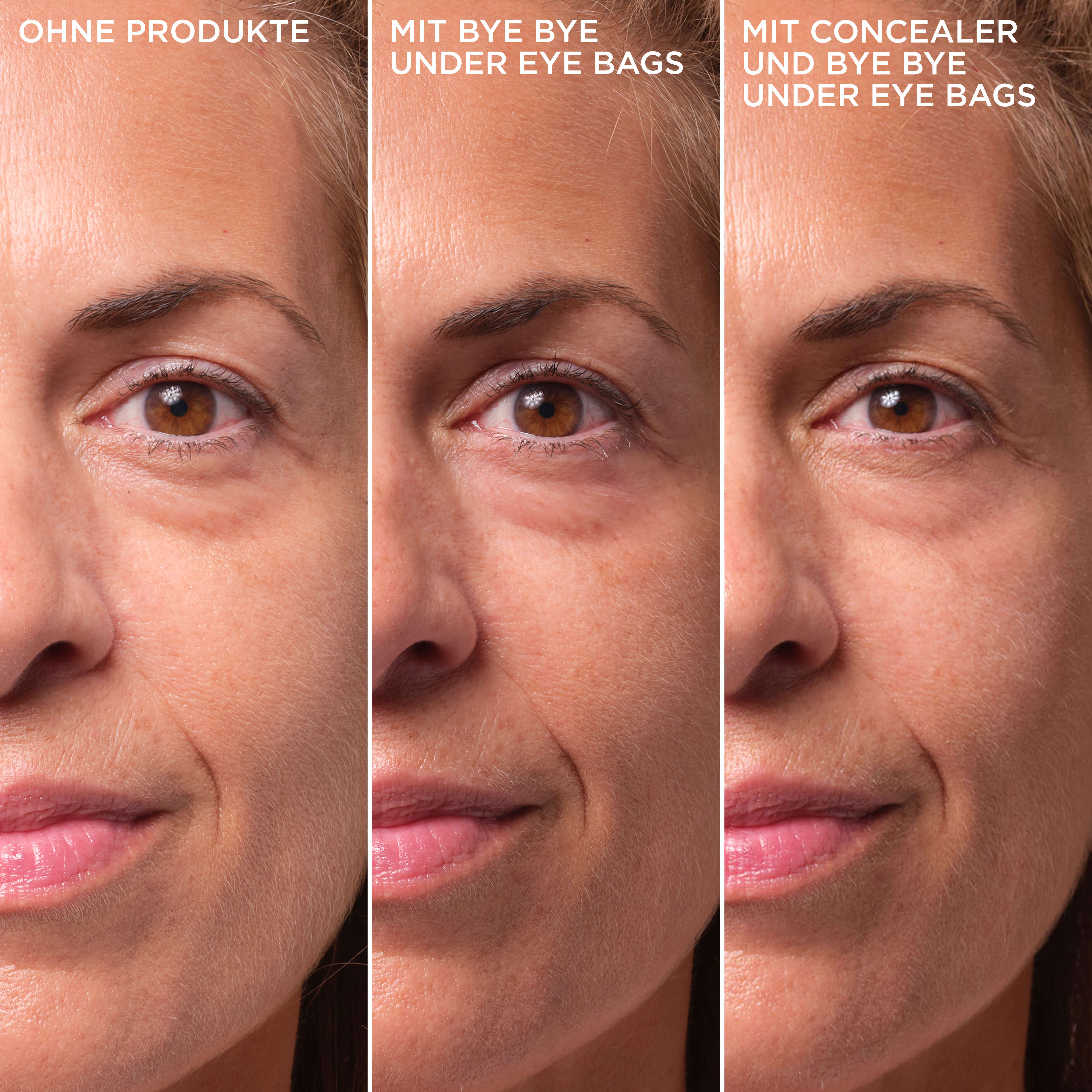 Bye Bye Under Eye Bags Treatment anwendung
