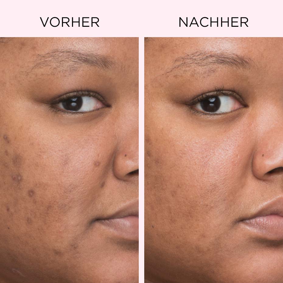 CC Cream Vorher/Nachher