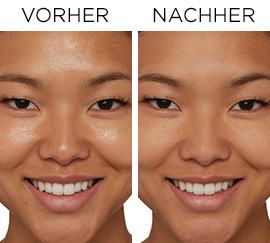 Bye Bye Pores Leave-on Solution Vorher/Nachher
