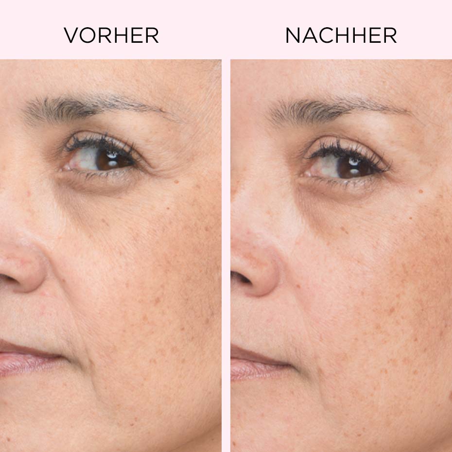 CC Cream Vorher/Nachher